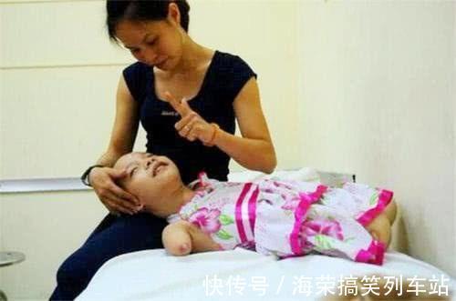星语心愿|怀孕7个月查出孩子没有手脚,妈妈不忍心放弃,如今活成“公主”