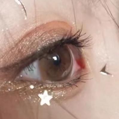 校花|女生想让“眼睛变大”这3个好习惯早坚持,逆袭“校花”不是梦