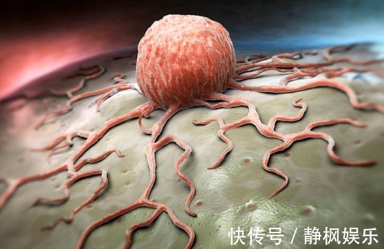 放化疗|得了肿瘤到底要不要放化疗,大夫说3类人一定不可放化疗