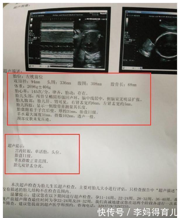 四维彩超|四维彩超不好过？医生：那是你没有提前了解注意事项