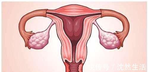 腺肌病|子宫好的3个表现,晨起时若有,恭喜,子宫是健康的
