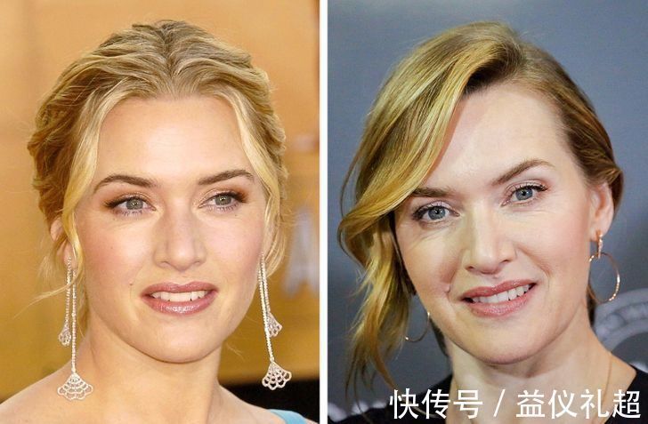 真实年龄|9个“直接戳破真实年龄”的衰老迹象,化妆也遮不住