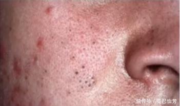 小白必看の护肤步骤