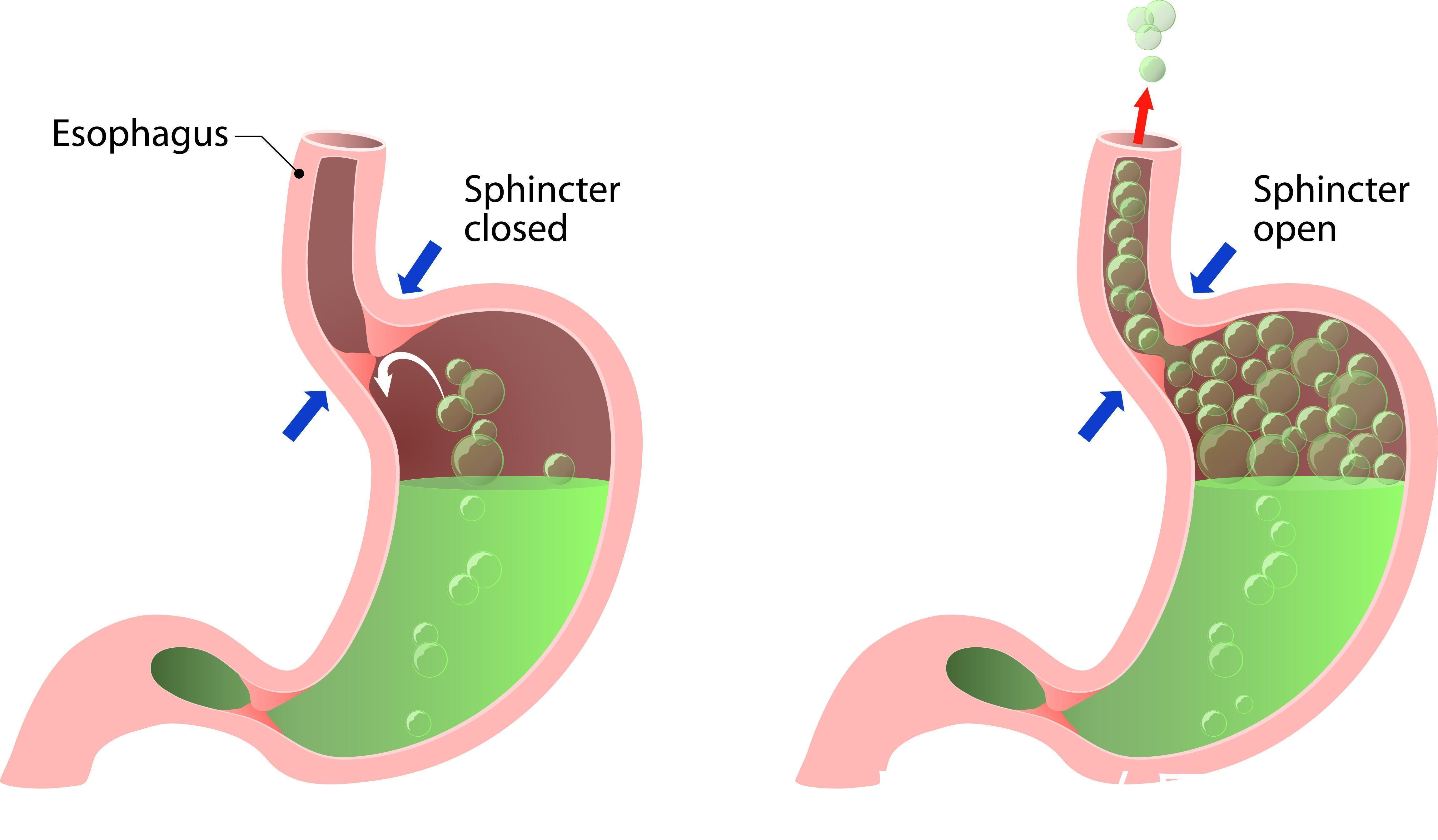 健康|脾胃出问题?看脸就知道!脸上若有这3种表现,说明脾胃有问题