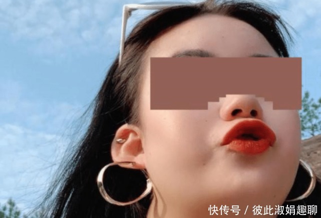 机构|女子贷款做隆鼻手术失败,医院看到塌陷鼻子后连夜改名:不是一家
