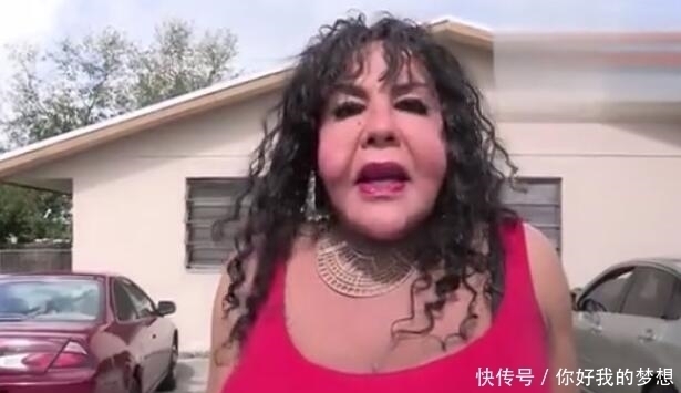 女子花2万元整容,整容失败变成“水泥脸”,看完你还想整容吗?