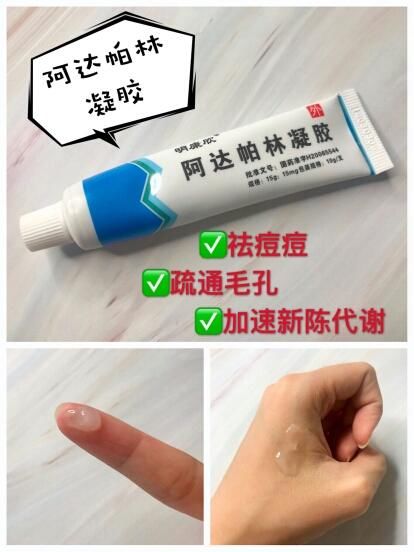 家里必备药膏,小问题再也不用求医了!你买对了吗?