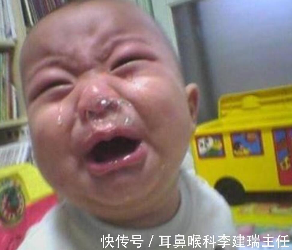 耳鼻喉科|五颜六色的鼻涕,暗藏鼻炎的健康玄机 可惜很少有人知道!