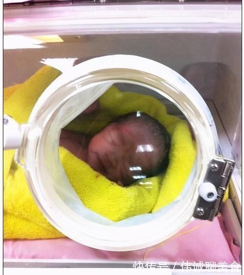 剖腹产|经过了一夜的待产,终于要跟宝贝见面了,我的剖腹产记录