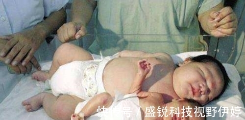 宝妈|产妇生下龙凤胎,哥哥吃奶粉,妹妹吃母乳,6个月后差距太大