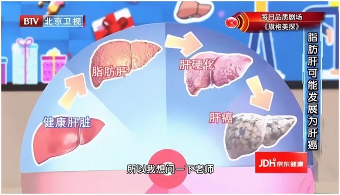 轻度脂肪肝也会增加71%的死亡风险！逆转“脂肪