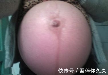 怀孕|孕妈怀孕7个月，宝宝无奈被引产，医生说出真相让全家人欣慰不已