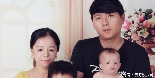 二宝|“鸟脸”妈妈不顾劝阻生二胎,二宝没躲过遗传,是任性还是母爱