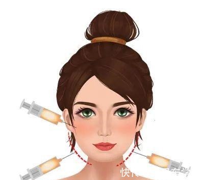 微针 医美入门干货丨常见医美项目种草与避雷_芯动医美课堂!