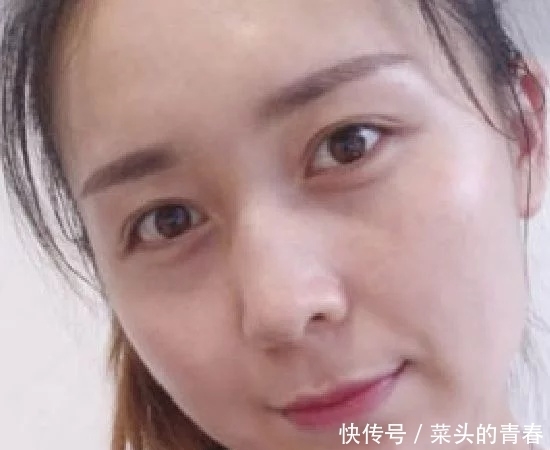 脸上长斑不要慌,巧用维E加生姜,仅需每晚敷下脸7天淡斑没风险