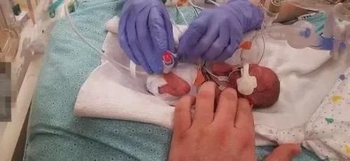 婴儿|婴儿刚出生就被判侏儒症停止发育,父母不愿放弃如今变成这样!