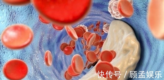 血脂|高血脂的“源头”已发现，肥肉没上榜，第1名大家几乎每天都吃