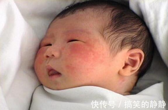 胎毒|孕晚期需要去“胎毒”吗孕妇做好5点,比吃鹅蛋要有效