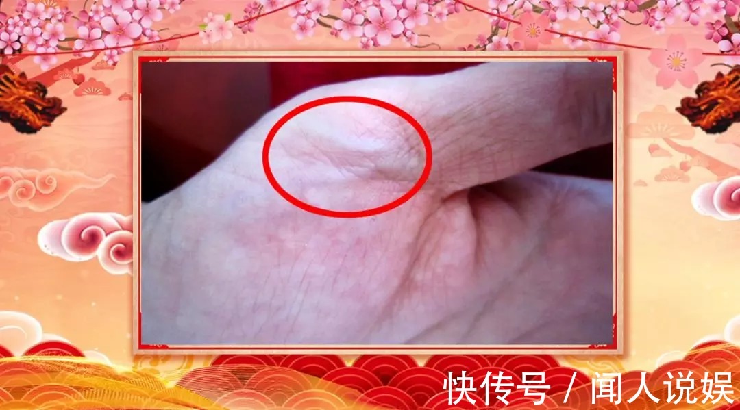 青筋|身体好不好,看手就知道!这几处变化可能藏大病