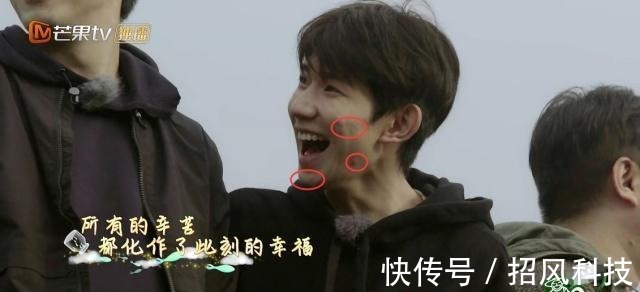 节目组失误关掉滤镜，王源满脸痘颜值大跌，杨超越皮肤不如董力！