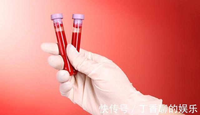 芝麻酱|内科主任:1种“零食”是甘油三酯的克星,若你爱吃,血脂蹭蹭降