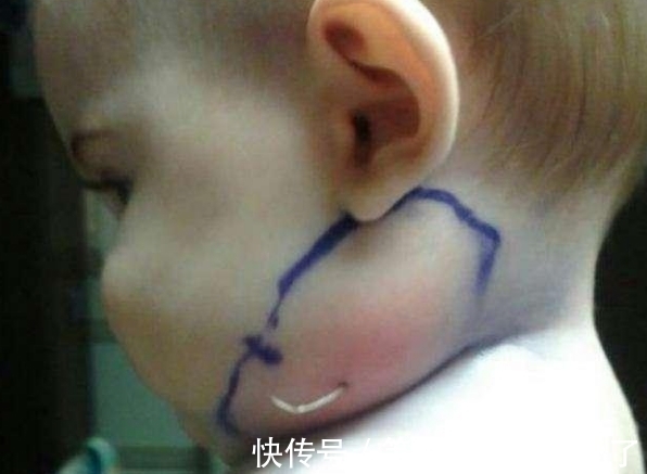 bober|女孩哭喊着挠脖子,到医院取出来的东西,全场人情绪失控