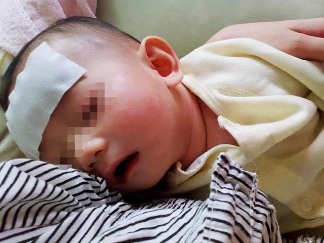 降温|宝宝突然发烧?多半是“幼儿急疹”,退烧后免疫力会成倍提升