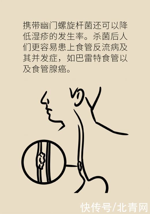 治病|杀菌就是治病？重新认识幽门螺旋杆菌和胃癌的关系