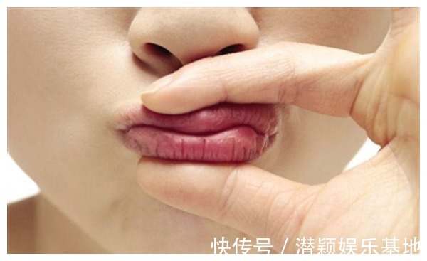 自测|女人有没有妇科病，看嘴巴或许就知道，对照自测，希望你一个没有