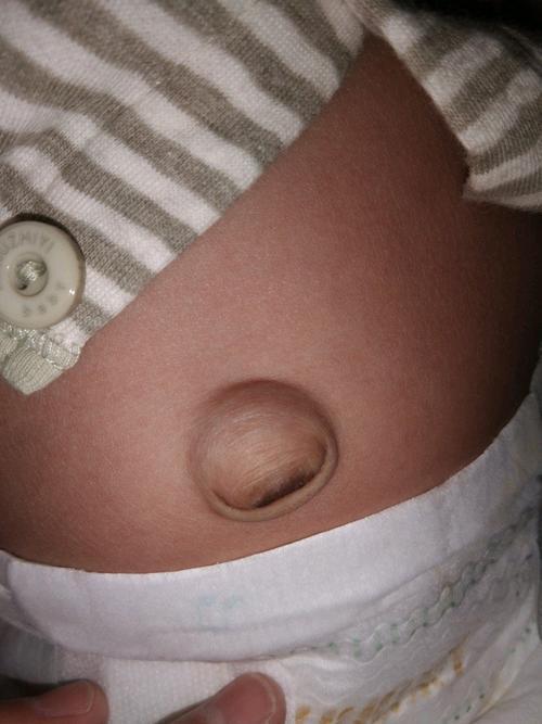 脐带|医院“黑脸宝宝”火了,宝妈耐心等待娃长大,长开后人人夸