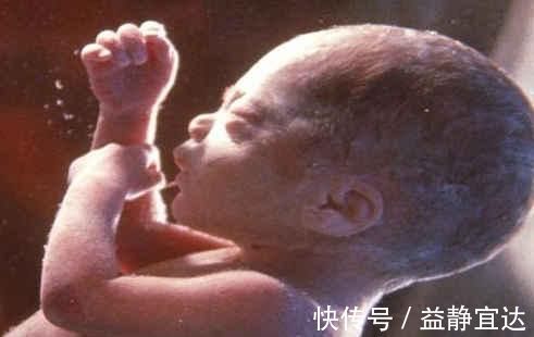 高峰期|胎儿畸形最喜欢出现在这个月份,孕妈只要熬过去就轻松了
