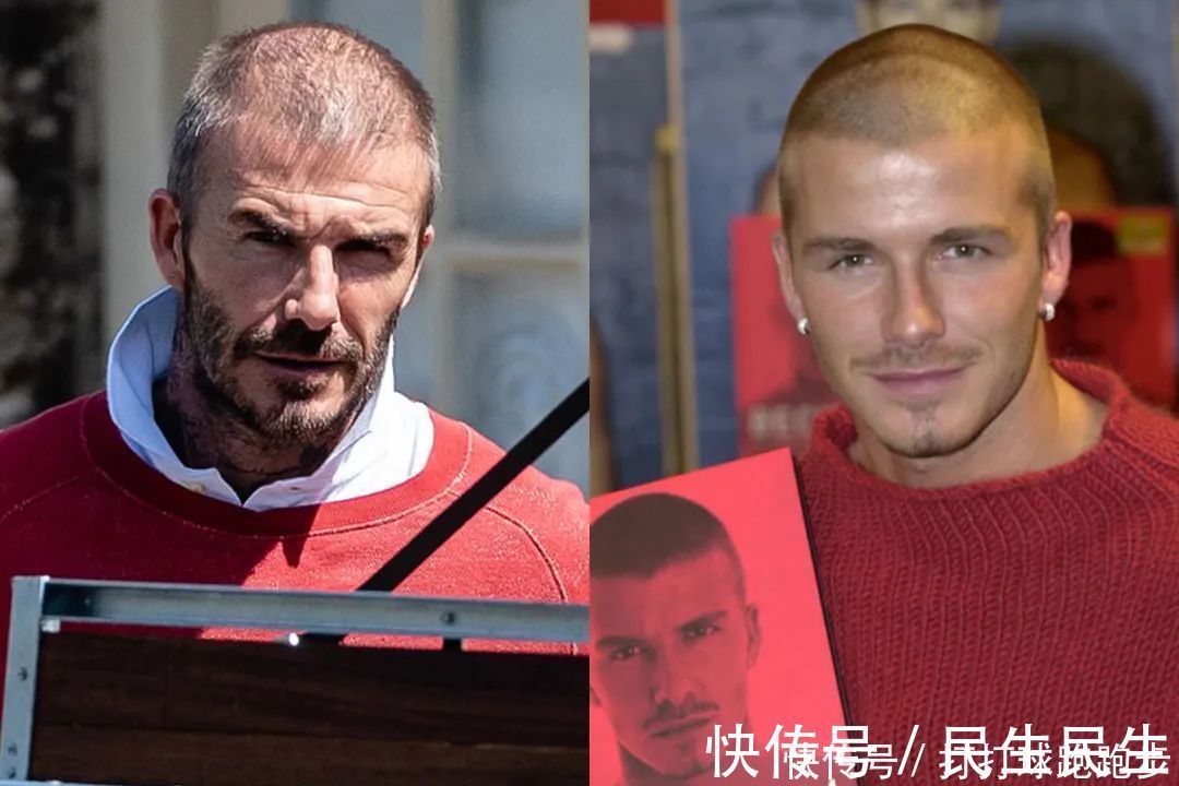 男士|45岁贝克汉姆也开始脱发了看来男士发量稀少,最好不要剪短发