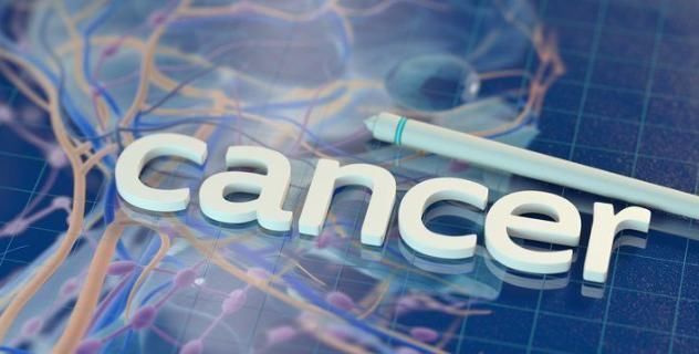 癌症|三种癌症比较难以治愈,存活期短,大家要引起注意