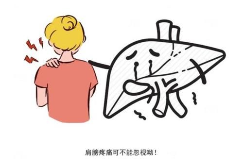 医院|体内有癌，肩膀第一个知道？肩膀出现这种迹象，最好去医院查肝CT