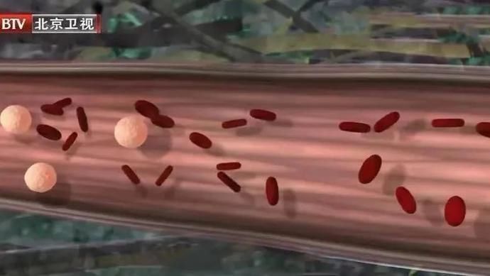 豆豉|揭开养生长寿的饮食密码！每天早上一碗它，和胃除烦、降低血脂、保护心脑血管~