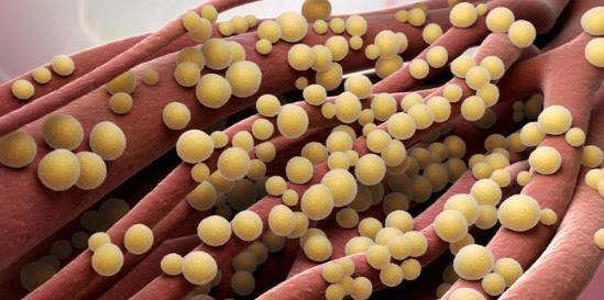 卫生棉|14岁少女使用卫生棉,却意外身亡,专家家长都不教怎么用