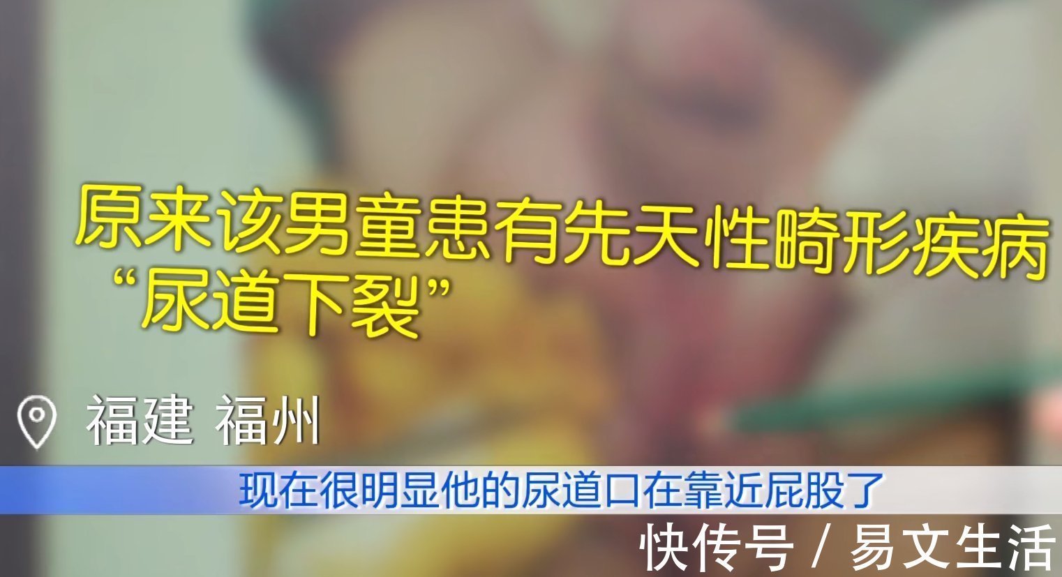 爷们|女童被养到三岁大,到医院一查是个“纯爷们”,医生也是头一次见