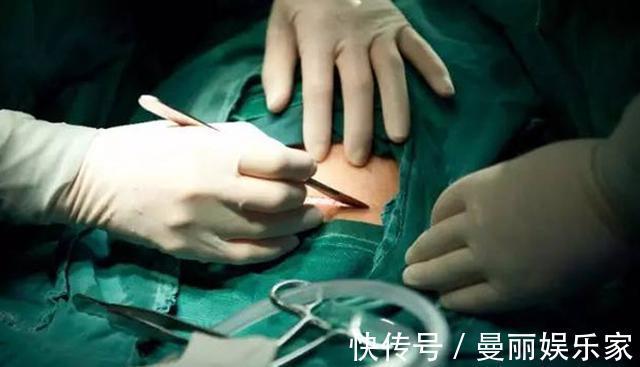 伤口|剖腹产仅是“挨一刀”对身体伤害有多大,医生终于说了大实话!
