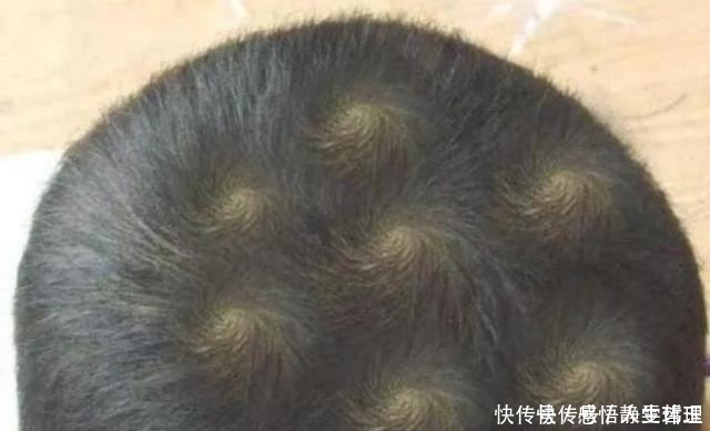 孩子头上的“旋”的个数,暗示孩子智商高低家长要了解真相