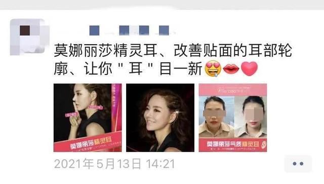 整容|医生，我耳朵不够精灵