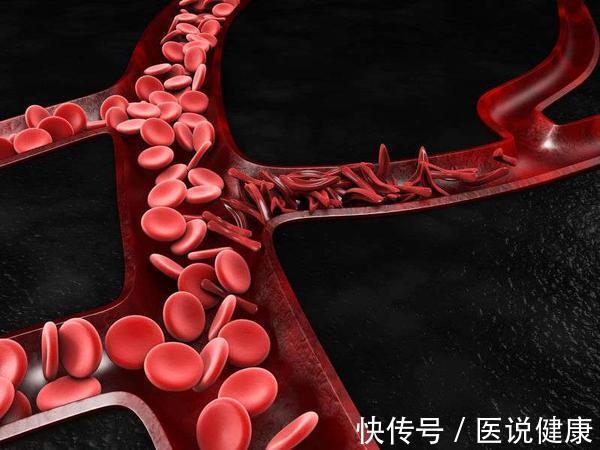 血液|身体有4症状,或是血管出问题了,做好这3点,或能保养血管