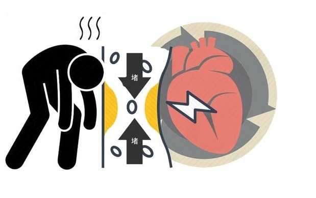 饮水|经常便秘要注意,3个危害在所难免,巧用3个方法,或许可以改善