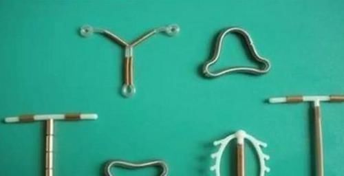 输卵管|生了孩子,医生问需要上环还是结扎,怎么选?这样说的男人值得爱