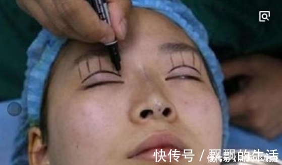 手术|手术割了双眼皮的人,老了之后有什么影响?看完真要留意了