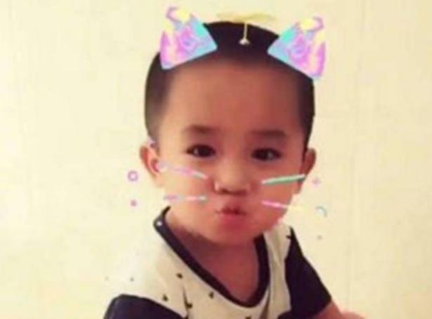 大花脸|产后抑郁多可怕?妈妈用剪刀把孩子划成“大花脸”,现恢复得很好