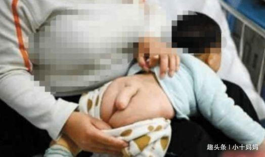 准妈妈|半岁男宝竟长出了“小尾巴”,送医院检查后,医生怒骂宝妈太无知