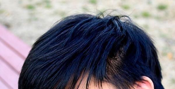 嫌弃|男性用过的枕头，为啥总是黄黄的医生作出解释，女性别嫌弃