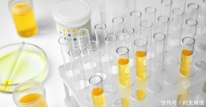 尿蛋白1十怎么调理?医生:现在明白也不迟