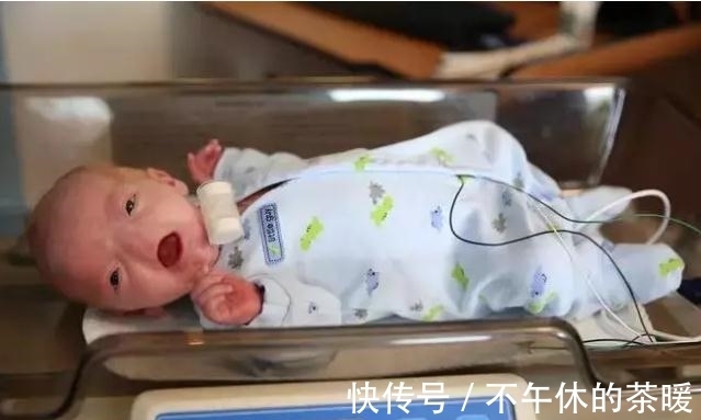 一生|小男孩天生无鼻,却坚持走完了一生