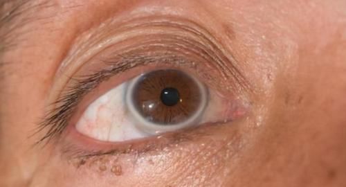 高血脂|“溶栓高手”公布,并非苦瓜,平时敞开吃,血管干净,远离头晕手麻